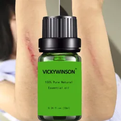 Élimination de la cicatrice - huile de massage de lavande 10 ml