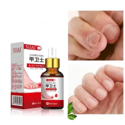 Gel d'élimination des champignons des ongles - sérum - anti-infection / paronychie / onychomycose - 10 ml