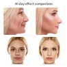 EMS eye massager - anti wrinkle - dark eye circles removal - hot compress - LED - USBMassage