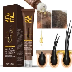 Essence de croissance des cheveux - huile de gingembre - anti chute de cheveux