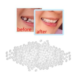 Kit de réparation temporaire des dents - comblement des lacunes - colle pour prothèses dentaires