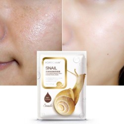 Masque pour le visage à l'essence d'escargot - hydratant - contrôle de l'huile - traitement de l'acné - 5 pièces