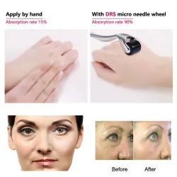 Derma roller - micro aiguilletage - aiguille en titane - pour visage/cou