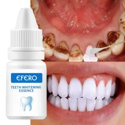 Sérum de blanchiment des dents - gel - hygiène bucco-dentaire - dentifrice