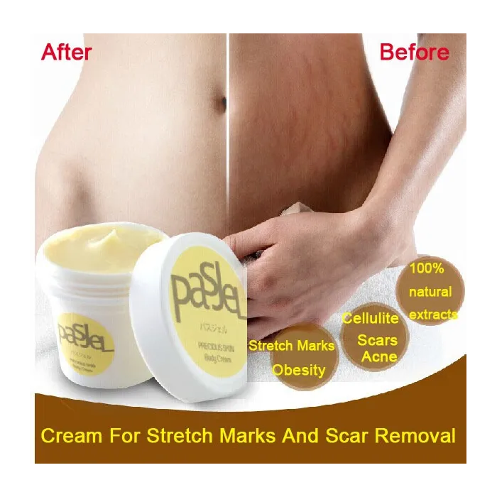 Stretch marks & cicatrices crème de suppression