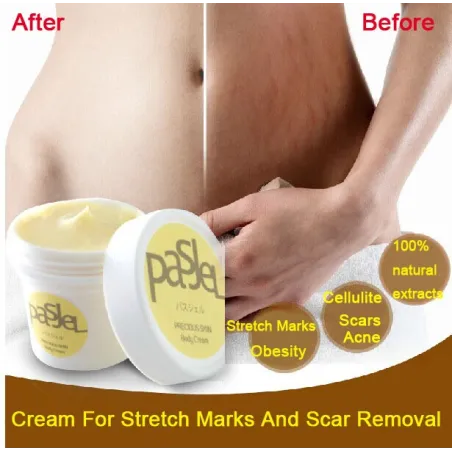 Stretch marks & cicatrices crème de suppression