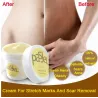 Stretch marks & cicatrices crème de suppression
