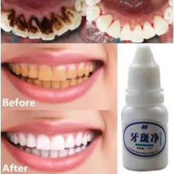 Eau de blanchiment de dents 10 ml