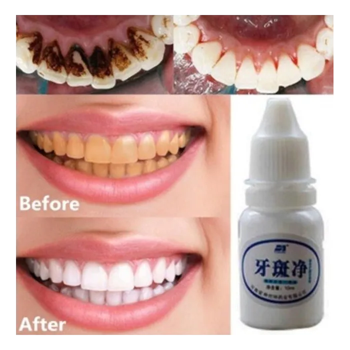 Eau de blanchiment de dents 10 ml