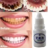 Eau de blanchiment de dents 10 ml