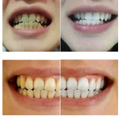 Eau de blanchiment de dents 10 ml