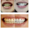 Eau de blanchiment de dents 10 ml